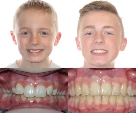 Bailey Orthodontics Bountiful and Farmington UT