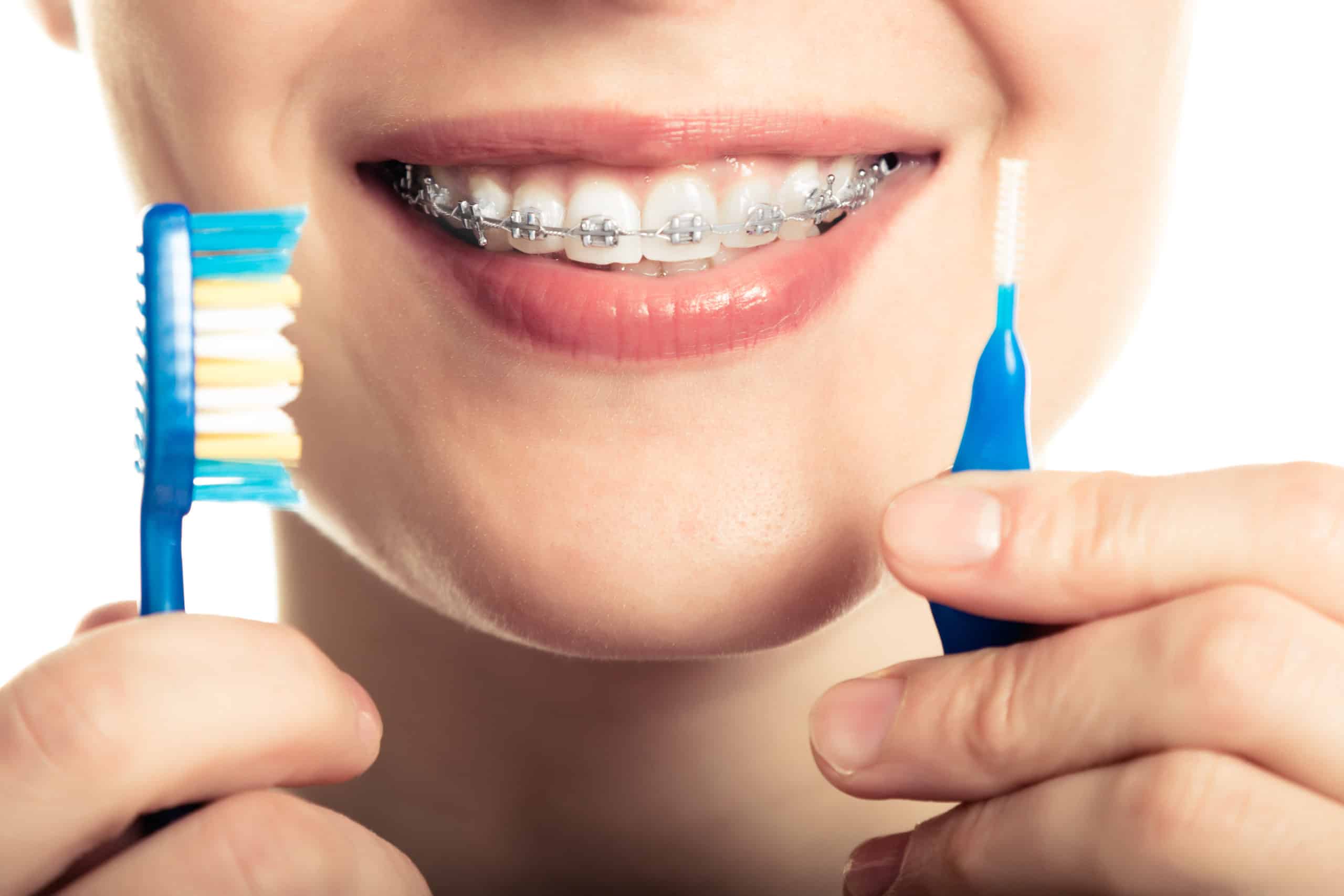 cleaning teeth with braces Bailey Orthodontics Farmington UT