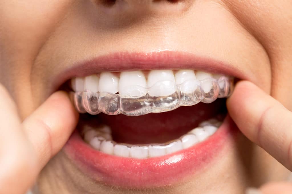 about orthodontics