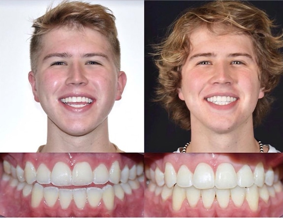 Orthodontist In Bountiful