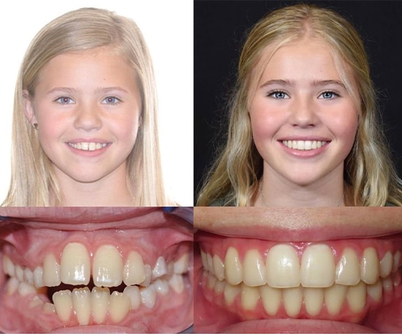 Bountiful UT Orthodontist