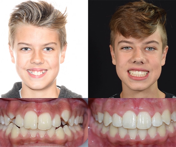 before-after-7