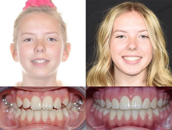 Orthodontist Bountiful Utah