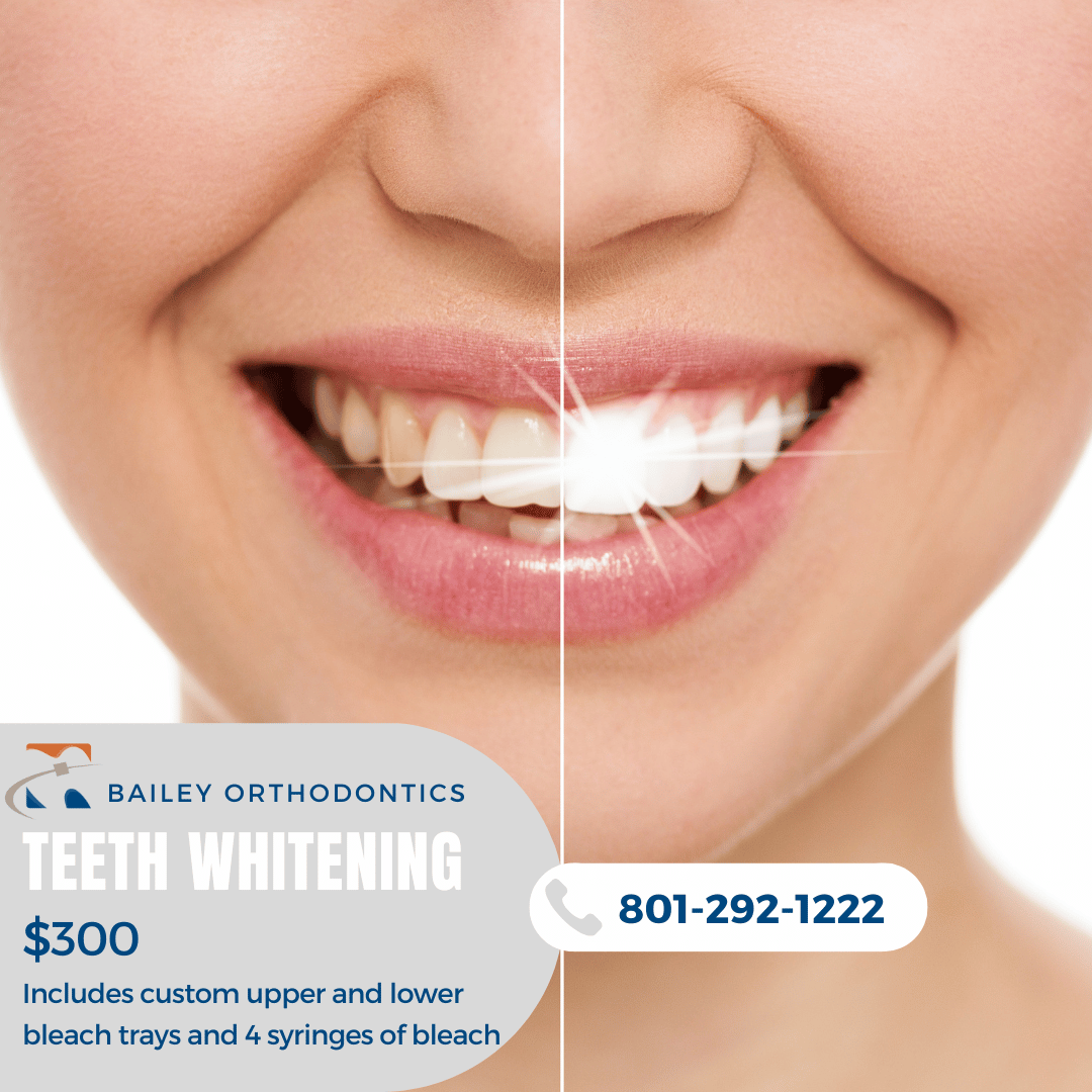 Promotions Bailey Orthodontics
