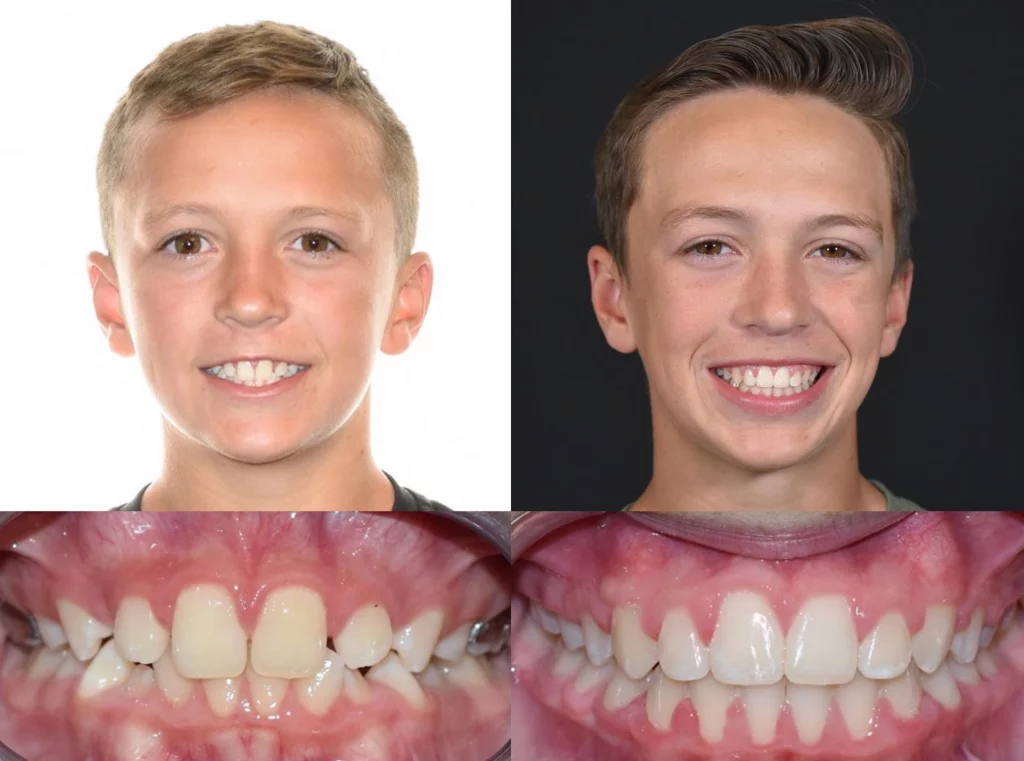 Orthodontist Farmington Utah